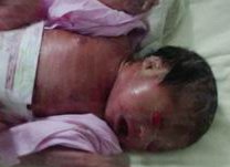 上海第十人民医院能为无子宫女性做人造子宫吗？